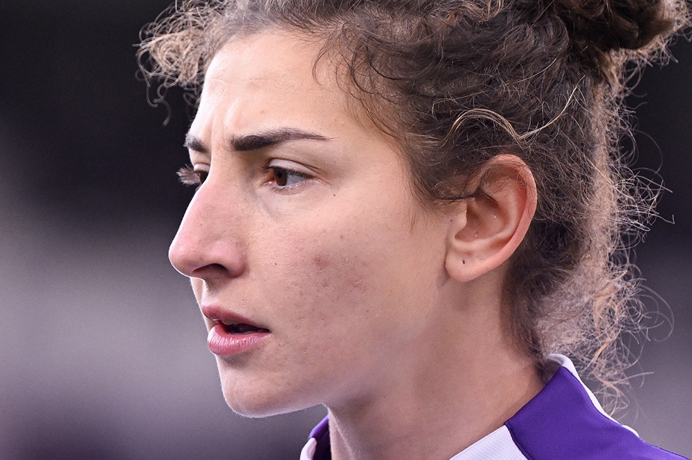 Fiorentina Femminile, infortunio per Miriam Longo: frattura da stress al metatarso